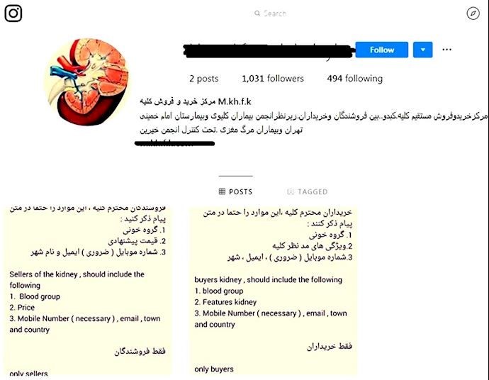 An Instagram post for buying and selling kidneys