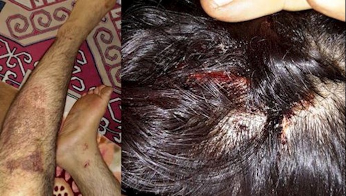 Mojahedin website reporter shot by pellet guns during the November uprising Mojahedin website reporter shot by pellet guns during the November uprising